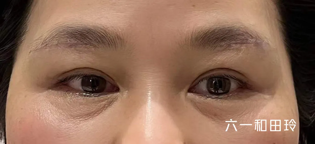 过年给妈妈最好的礼物，就是隐形眉眼提升