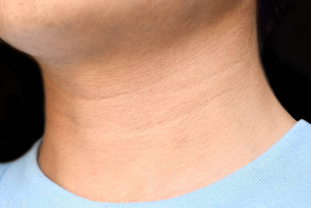 暴露年龄的颈纹如何祛除-暴露年龄的颈纹如何祛除小妙招 - 114知识网