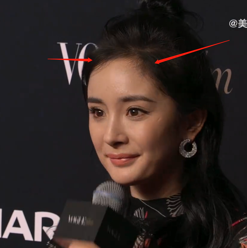 额头上新生的小碎发清晰可见,而发际线粉也是很多备受发量困扰的明星