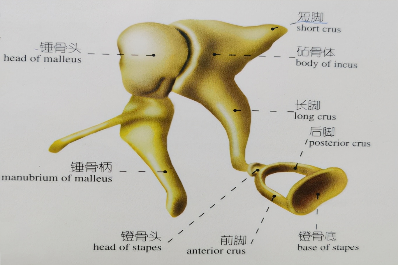 左半边莫西干头，右半边中长卷发，我在病友注目礼下进了手术室
