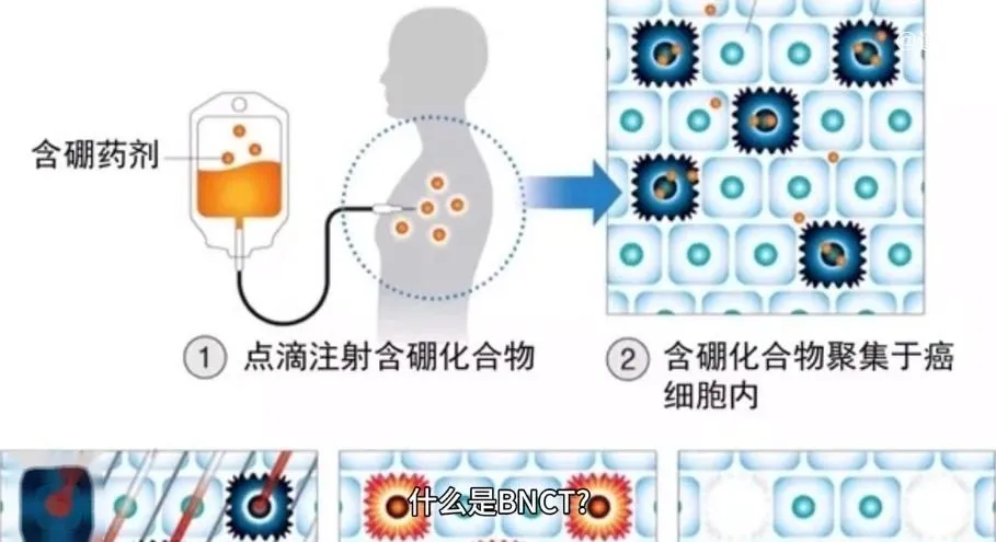 中国首款抗癌硼药将面世：30分钟杀死癌细胞！价格或为10万左右