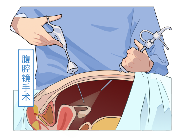 男性结扎和女性结扎，哪个伤害更大？男性结扎会降低性能力吗？