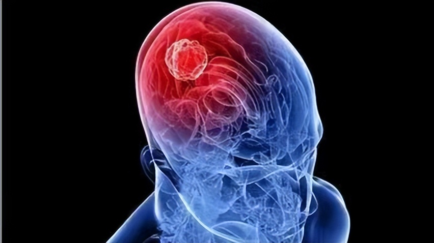 儿童脑瘤,手抖竟是噩梦的开始