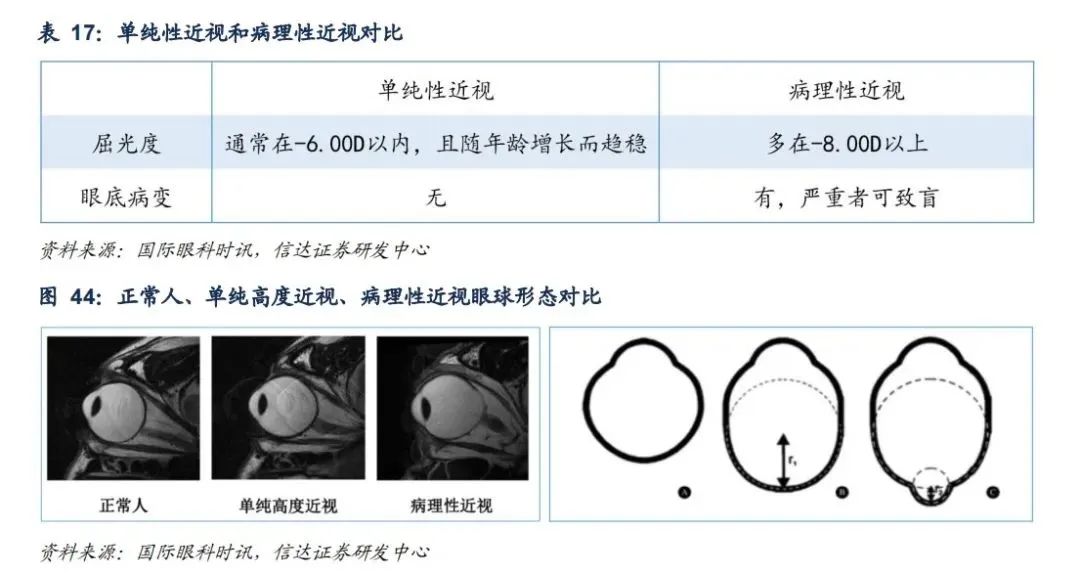 “中国爱德华”布局眼科，董事长重金增持