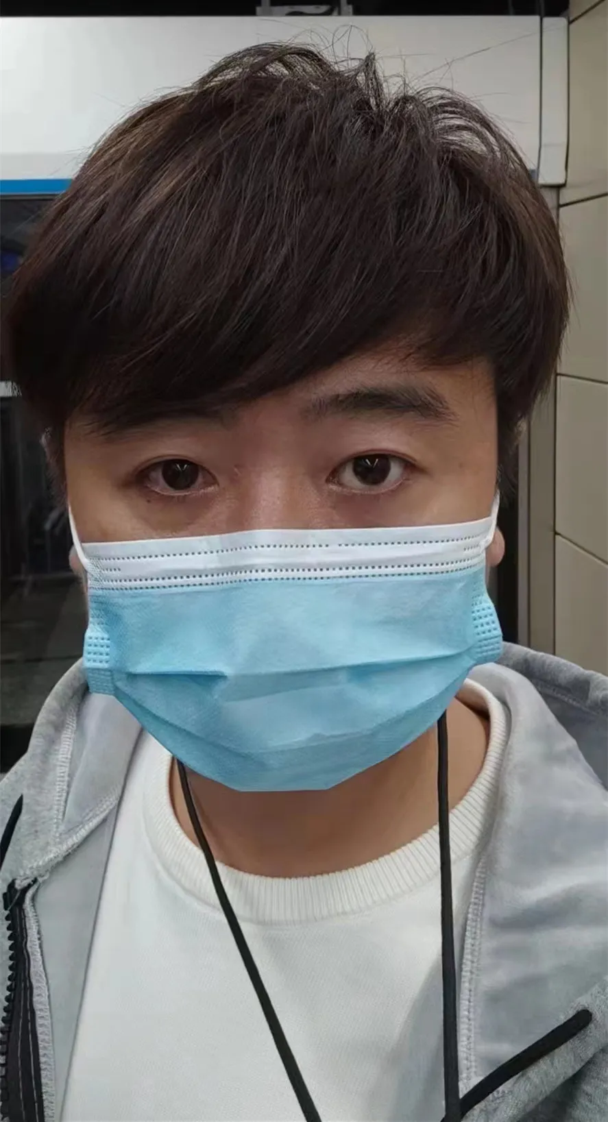 河南省直第三人民医院成功实施“废用性斜视矫正+筋膜固定术”,让患者重拾自信