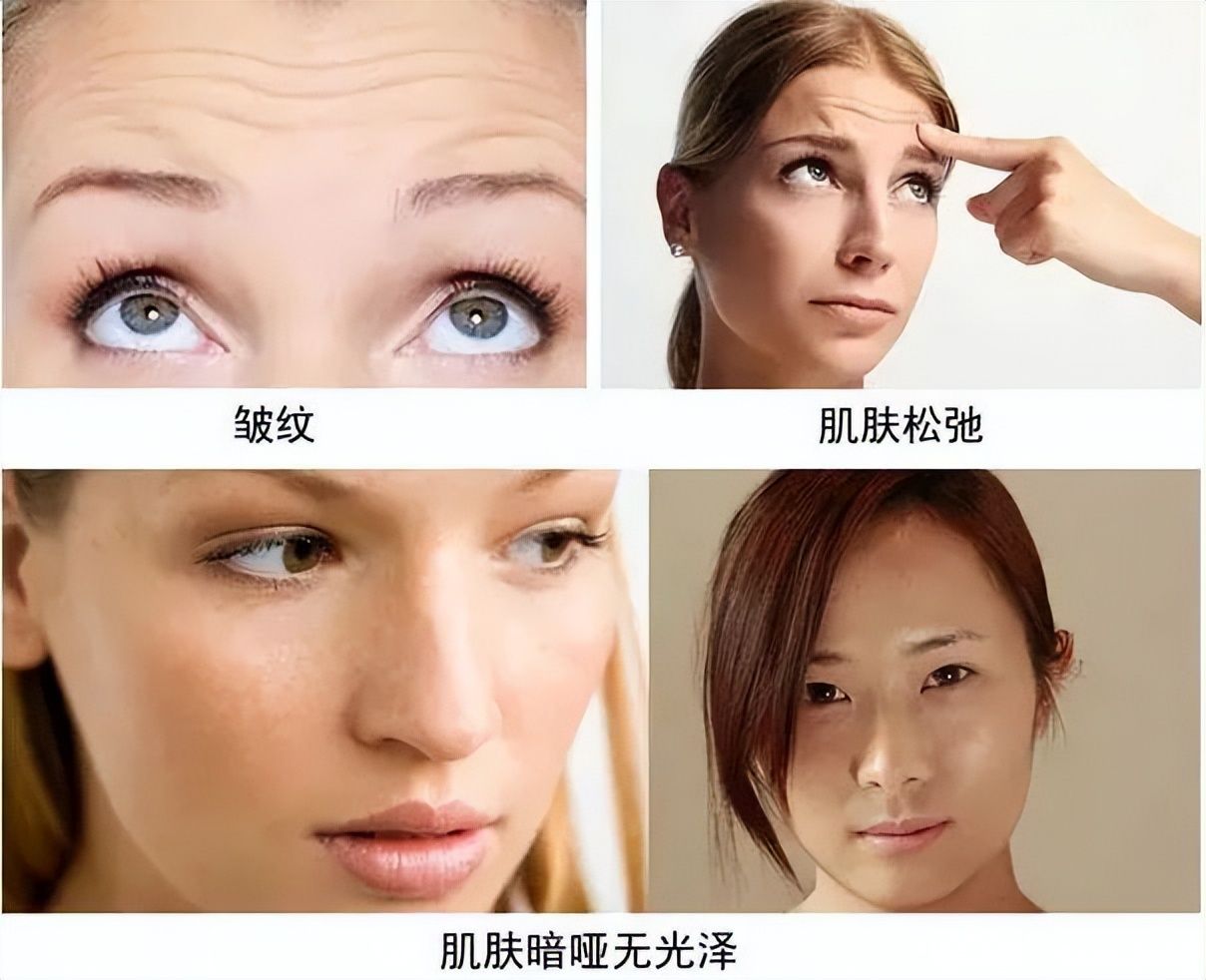 你的肌肤状态正在下降吗？皱纹来袭，蔓柚轻松解决