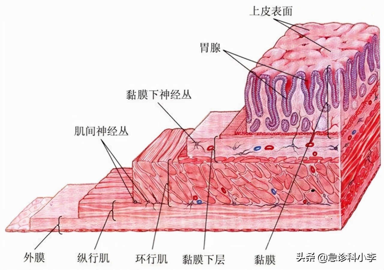 幽门螺杆菌是中国胃癌最大的祸根,牢记3个办法彻底根除