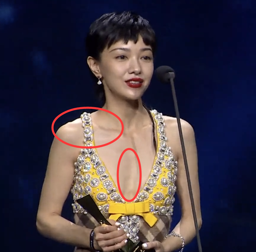 皮包骨,排骨胸,这些明星瘦成了一道"闪电",畸形审美何时休