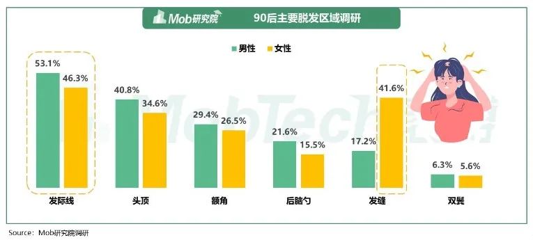 年轻人头发报告：每 4 位男性就有1人脱发