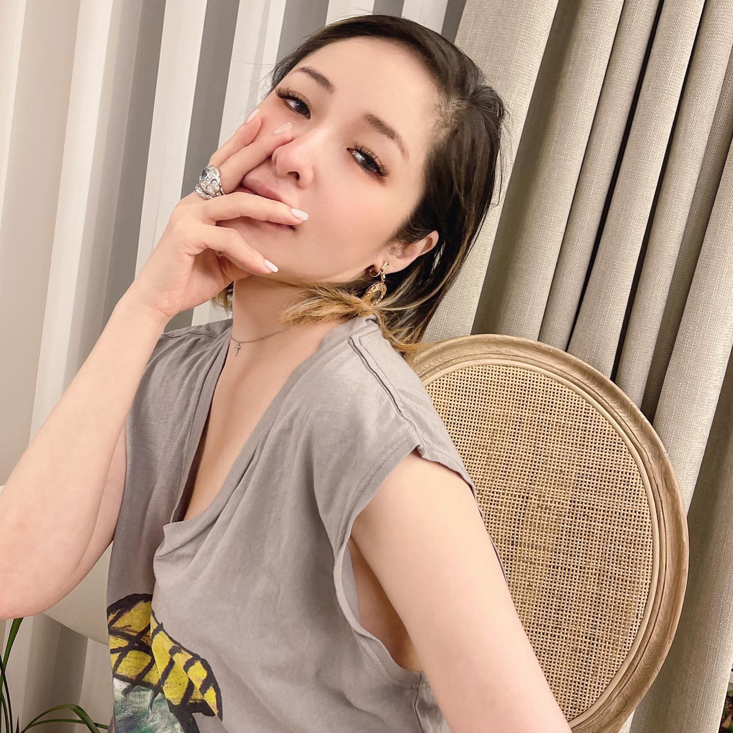 萧亚轩宣告正式复出，脸上被爱犬咬伤的伤疤清晰可见