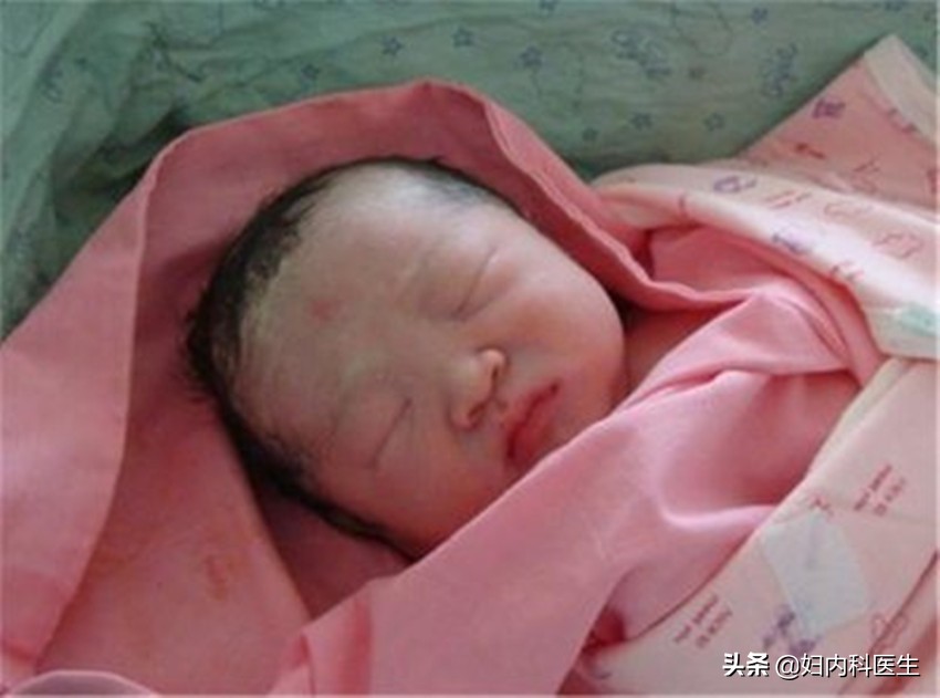 新生儿黄疸指数偏高接受蓝光照射惨死,黄疸有必要用蓝光照射吗?