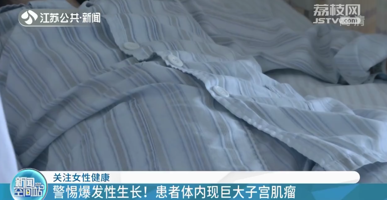 南京：女子体内现巨大子宫肌瘤 肚大如怀孕四五个月