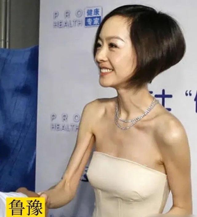 肋骨明显突出，身子干瘪，那些瘦过头的女星