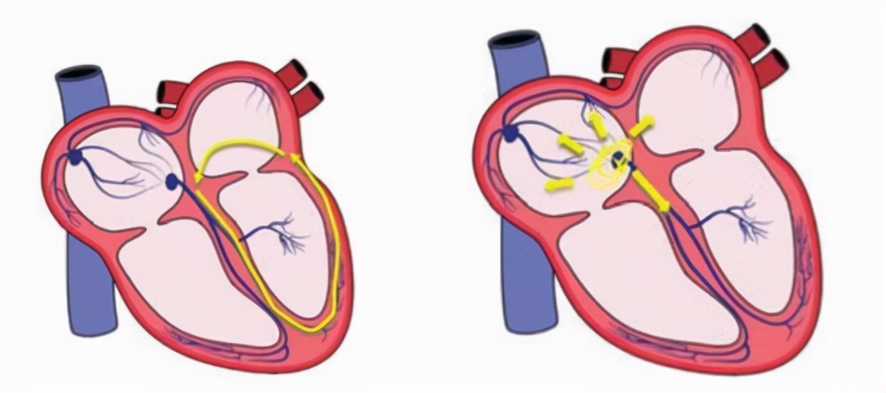 “吃姜不去皮，吃错害自己”？吃生姜到底要不要去皮？不要做错了