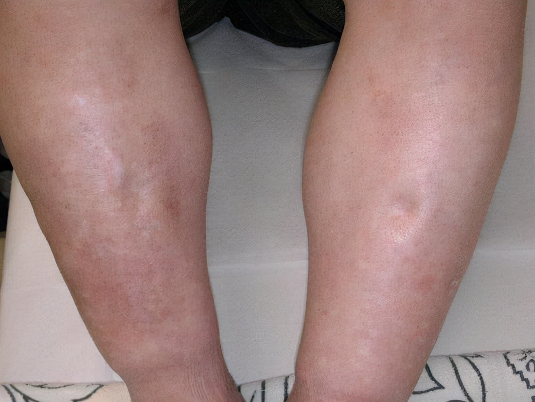 “吃姜不去皮，吃错害自己”？吃生姜到底要不要去皮？不要做错了