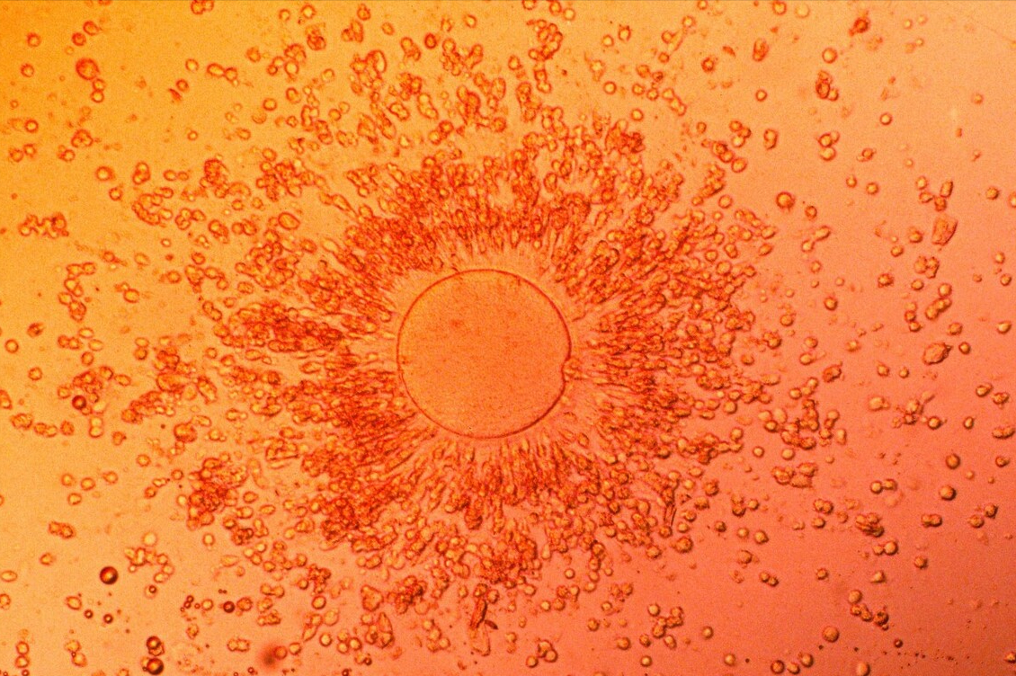 冷冻后,精子卵子反应各不同