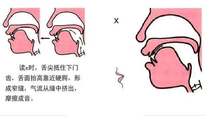 jqx发音不准，怎么教都改不掉，语言矫正师告诉你原因在哪里