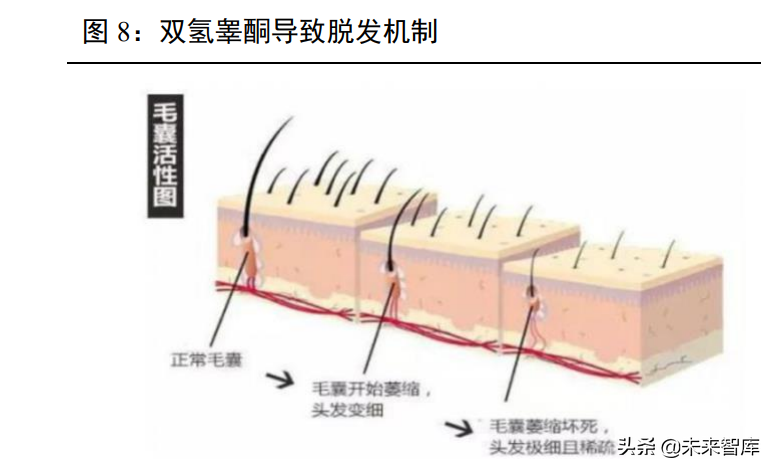 植发医疗行业专题报告：“头”等大事牵动千亿毛发市场