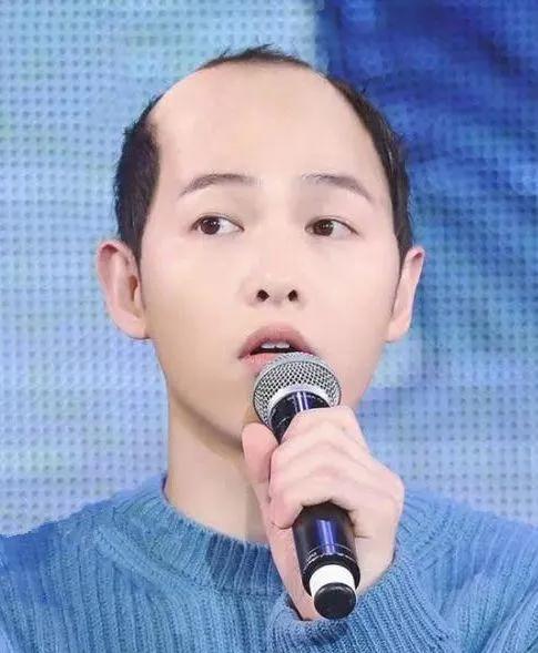 如果明星秃顶了，你还觉得他们帅吗？