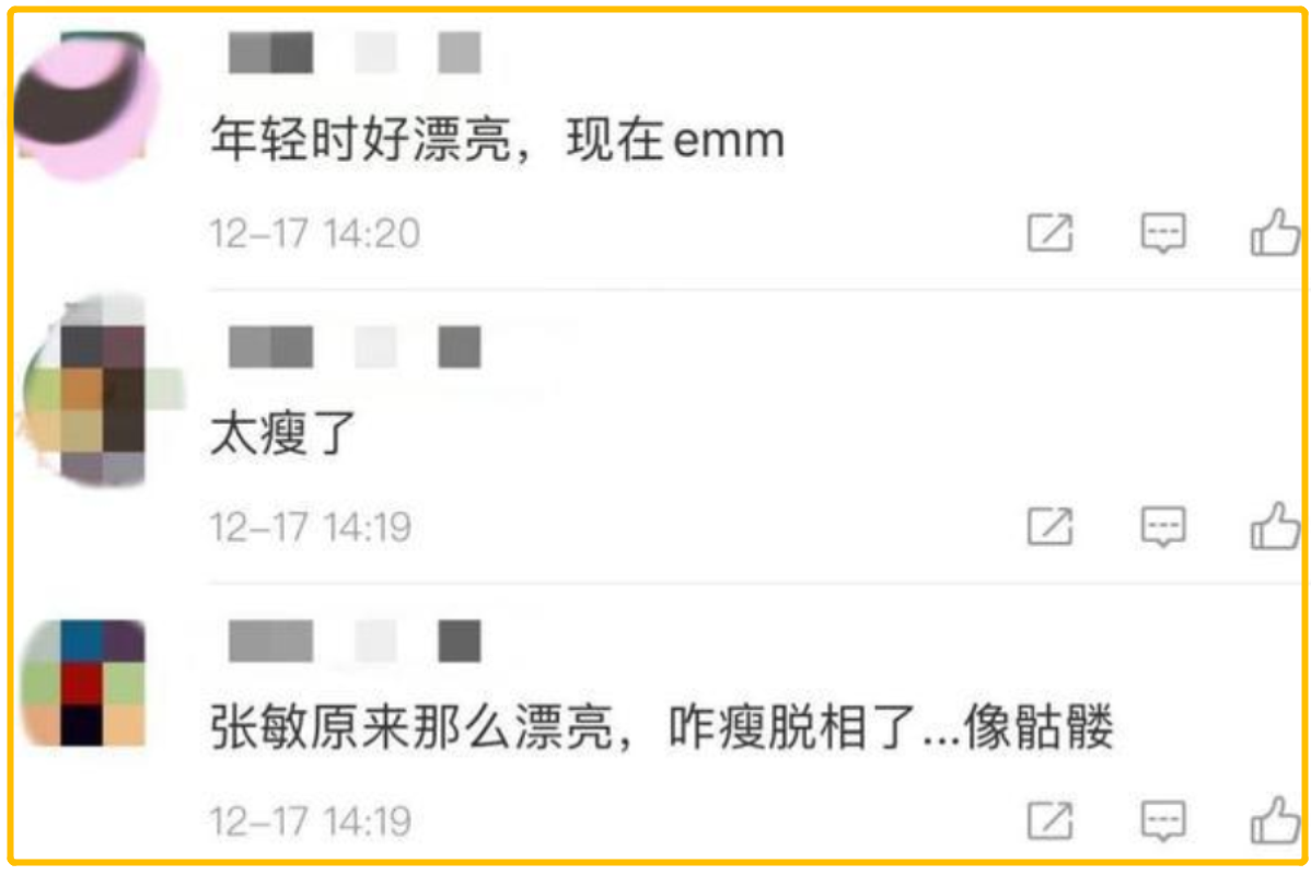 明星瘦过头比胖了更难看？有人排骨胸吓人，有人瘦到没戏拍