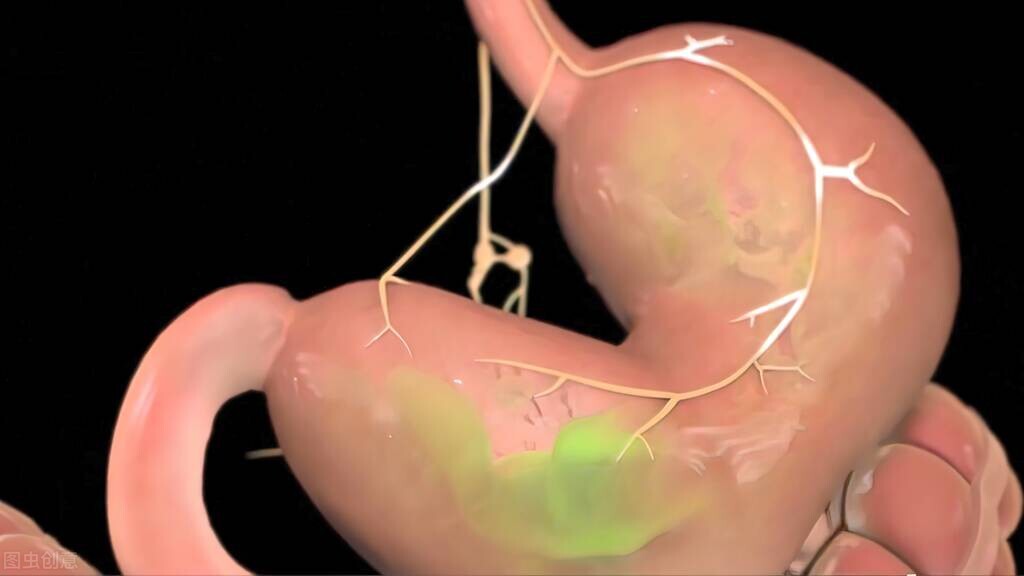 为什么胸口会突然"刺痛"?这是心脏病信号吗?一文为你揭晓真相