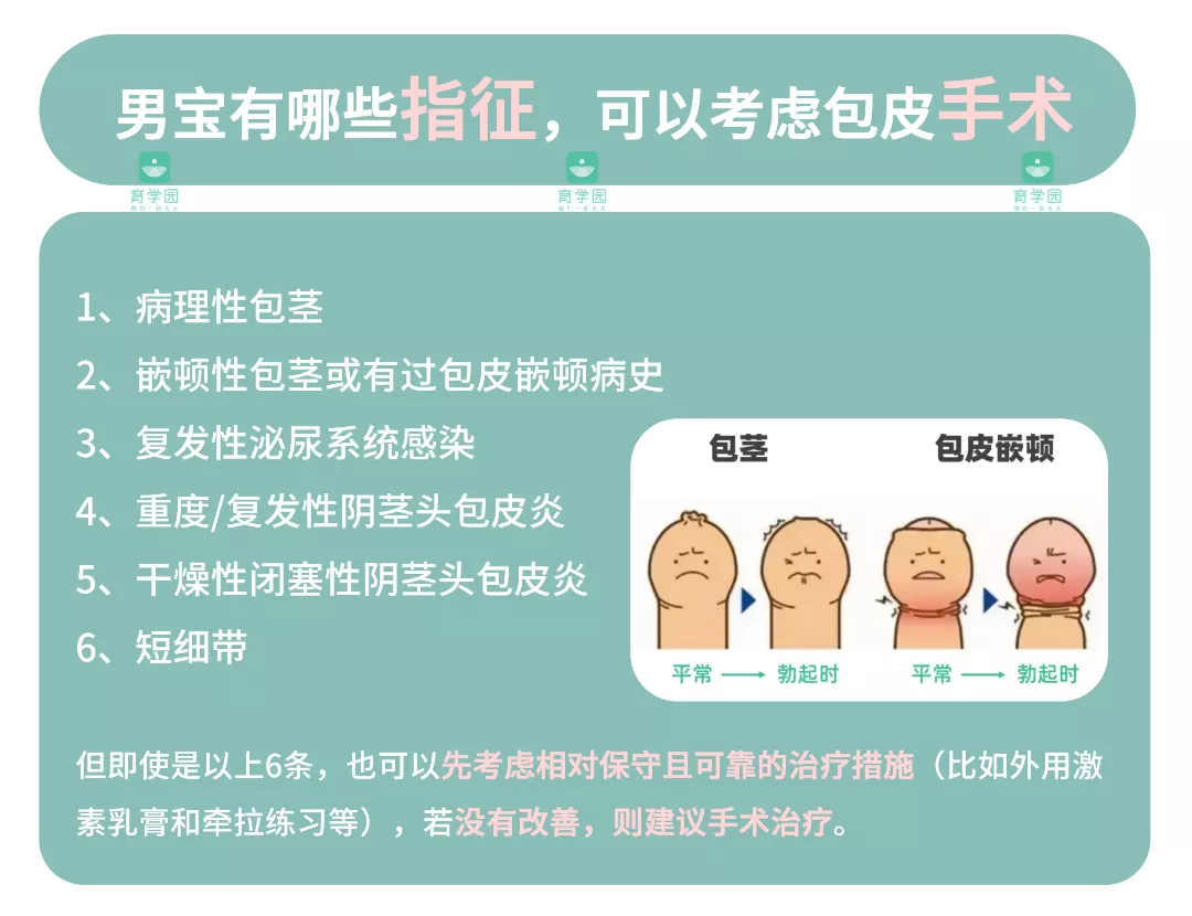 家长们千万别盲目跟风,"别人家小孩都割了包皮"并不是给自己小孩也割