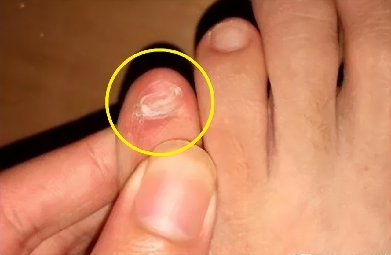 你的指甲也这样吗?