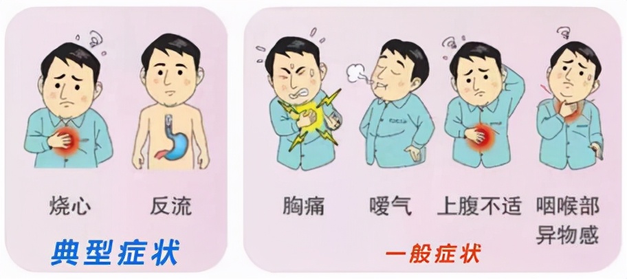 反流性食管炎经常反酸、烧心不舒服？建议少碰这9种食物