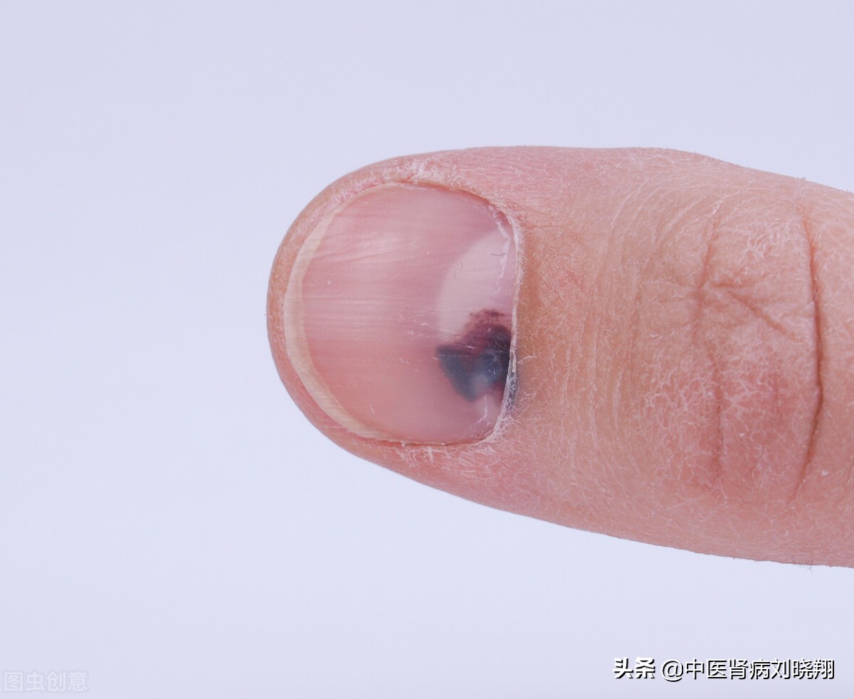身体出现“5黑3疼”，可能是肾脏出现异常的信号，你中招了吗？