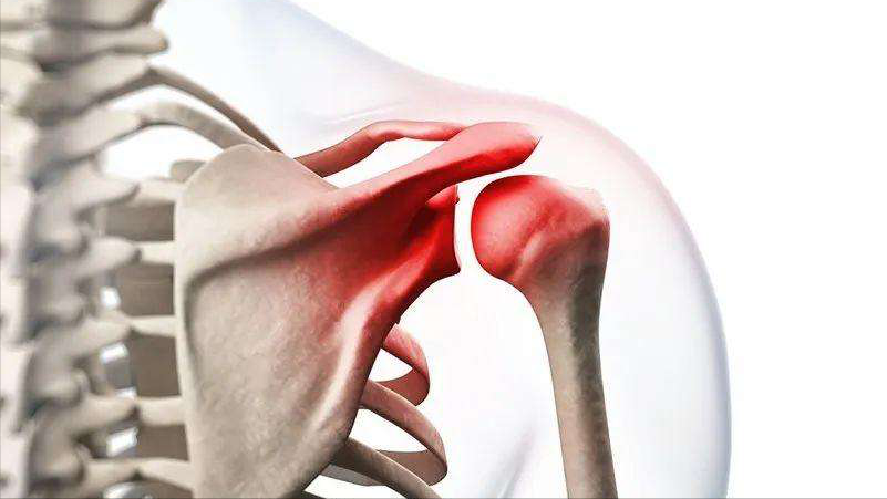 肩关节由肱骨上端,肩胛骨和锁骨组成,是人体活动范围最大的一个关节.