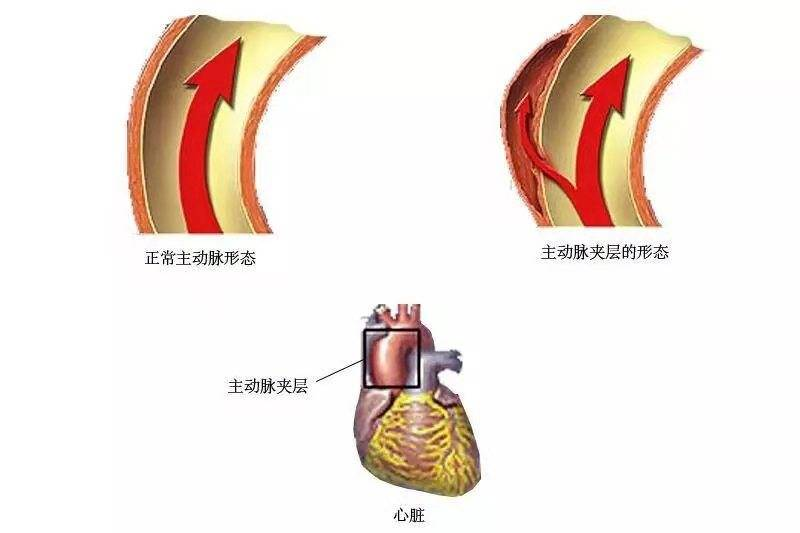 总感觉后背疼痛？骨科医生提醒：或许是这几个问题导致，可大可小
