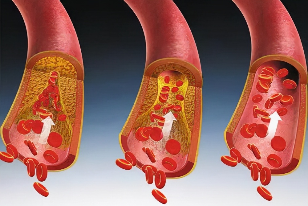 吃晚饭时，长期喝点“白酒”的人，身体会怎样？