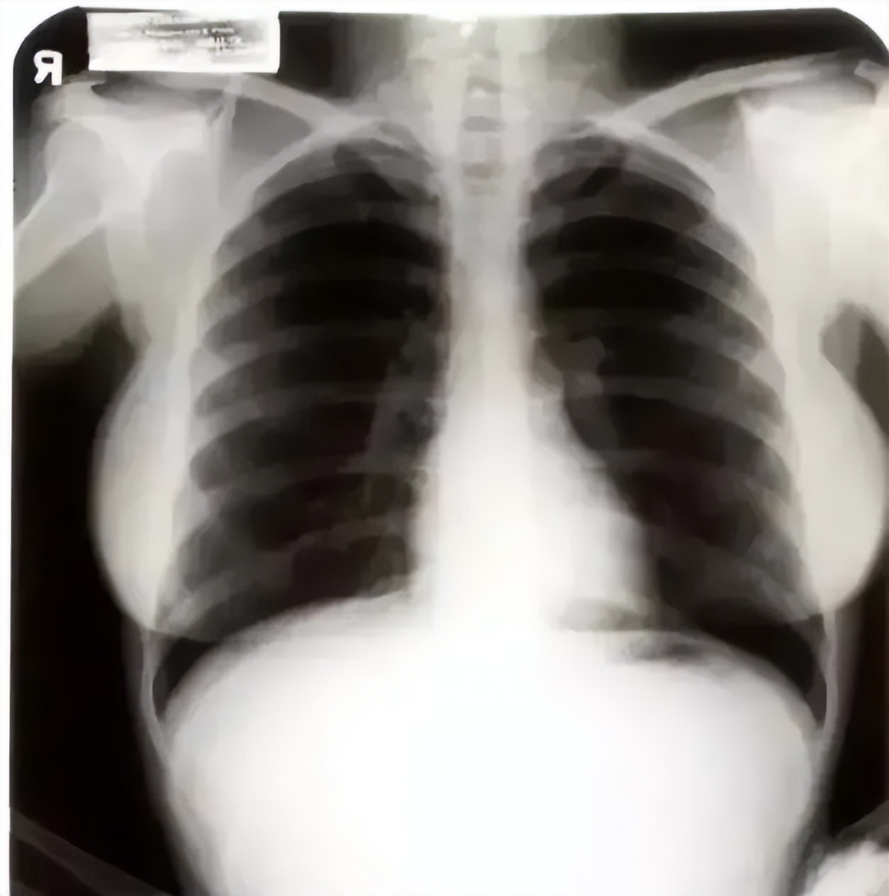 冉莹颖这是咋了？怎么突然美成吉娜了？？老公邹市明看傻了