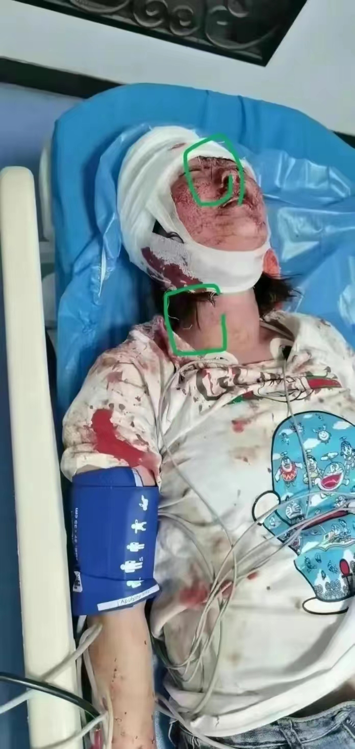 唐山事件大反转：陈继志50万请律师被拒，被害方首次透露重要信息