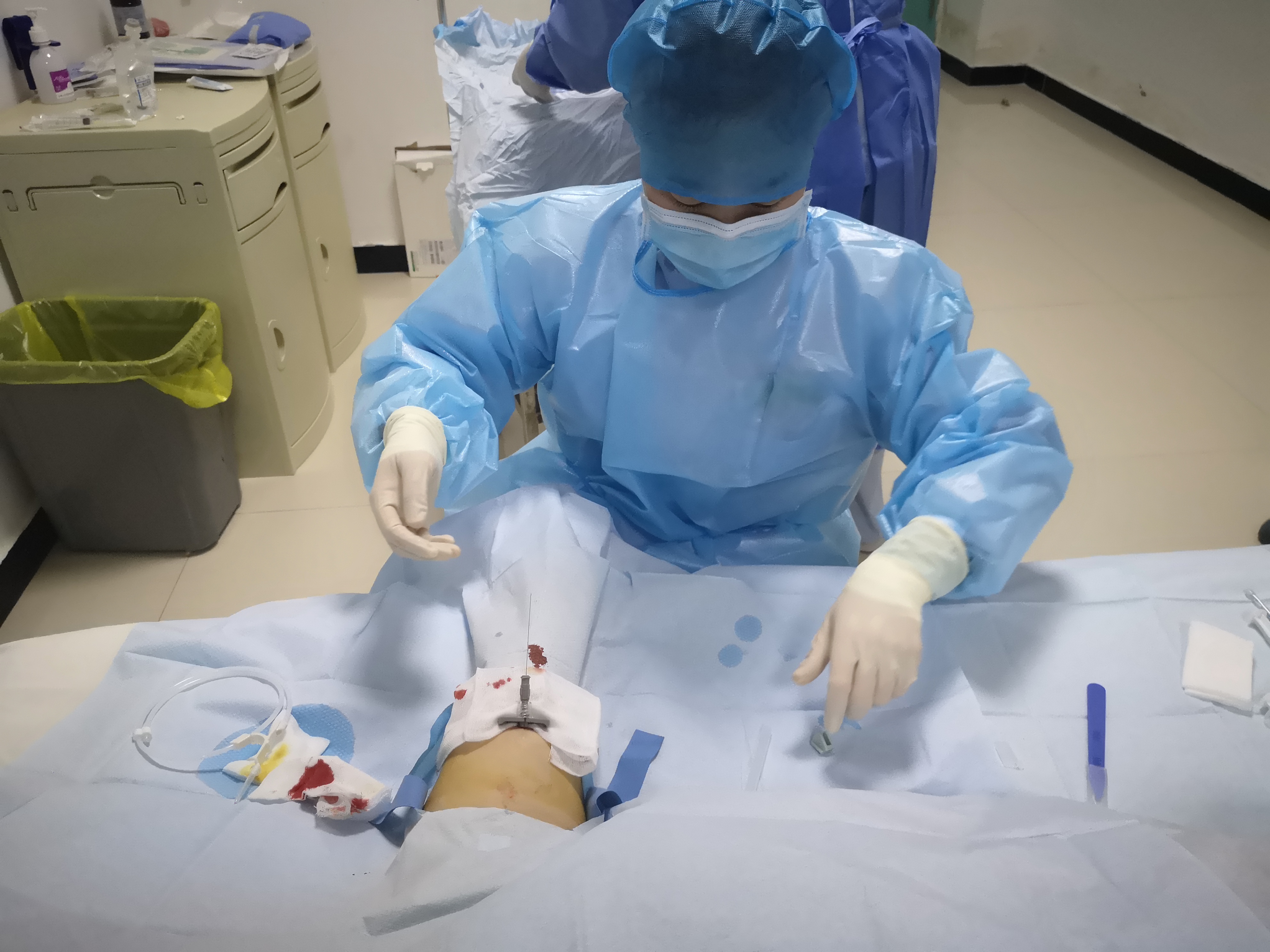 渭南市妇幼保健院开展首例手臂静脉输液港植入术