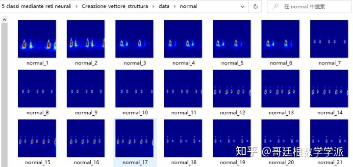 基于连续小波变换和GoogLeNet的PCG心音信号分类算法