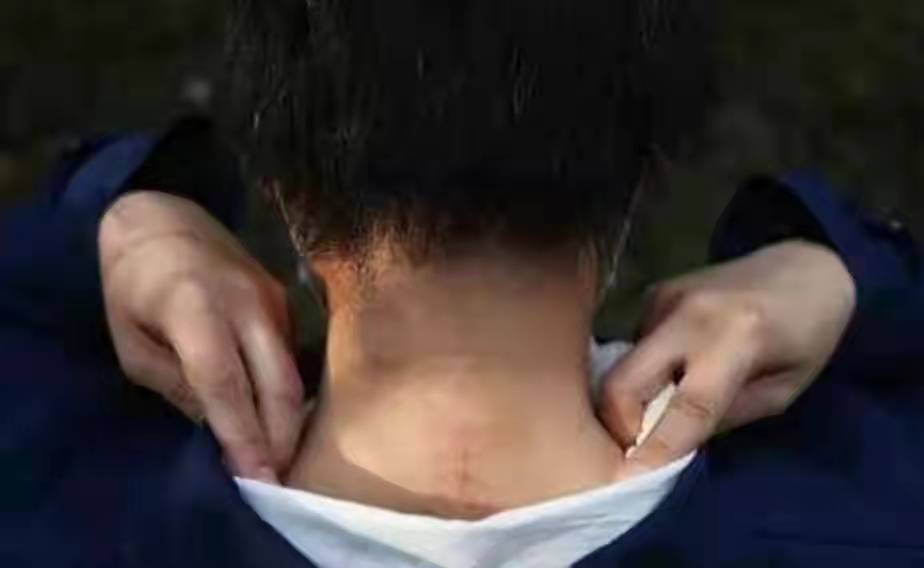 轰动一时的八达岭老虎咬人案：幸存者索赔百万失败，因毁容无工作