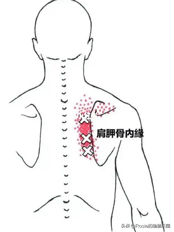 弓韩国电影完整版(泫雅晒美背超吸睛，没时间健身如何轻松解锁少女背？4步带你练)