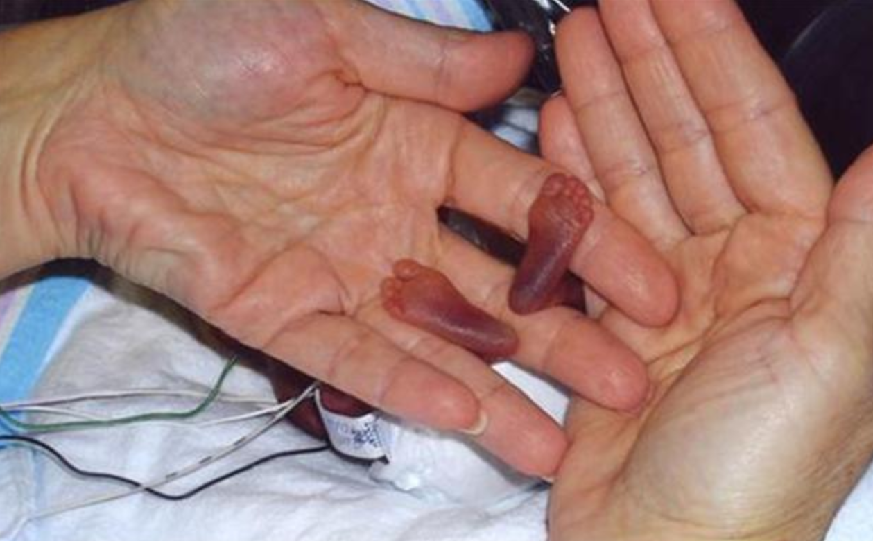 人们常说怀胎十月,那是因为胎儿在40周左右才具备脱离羊水独立生存的