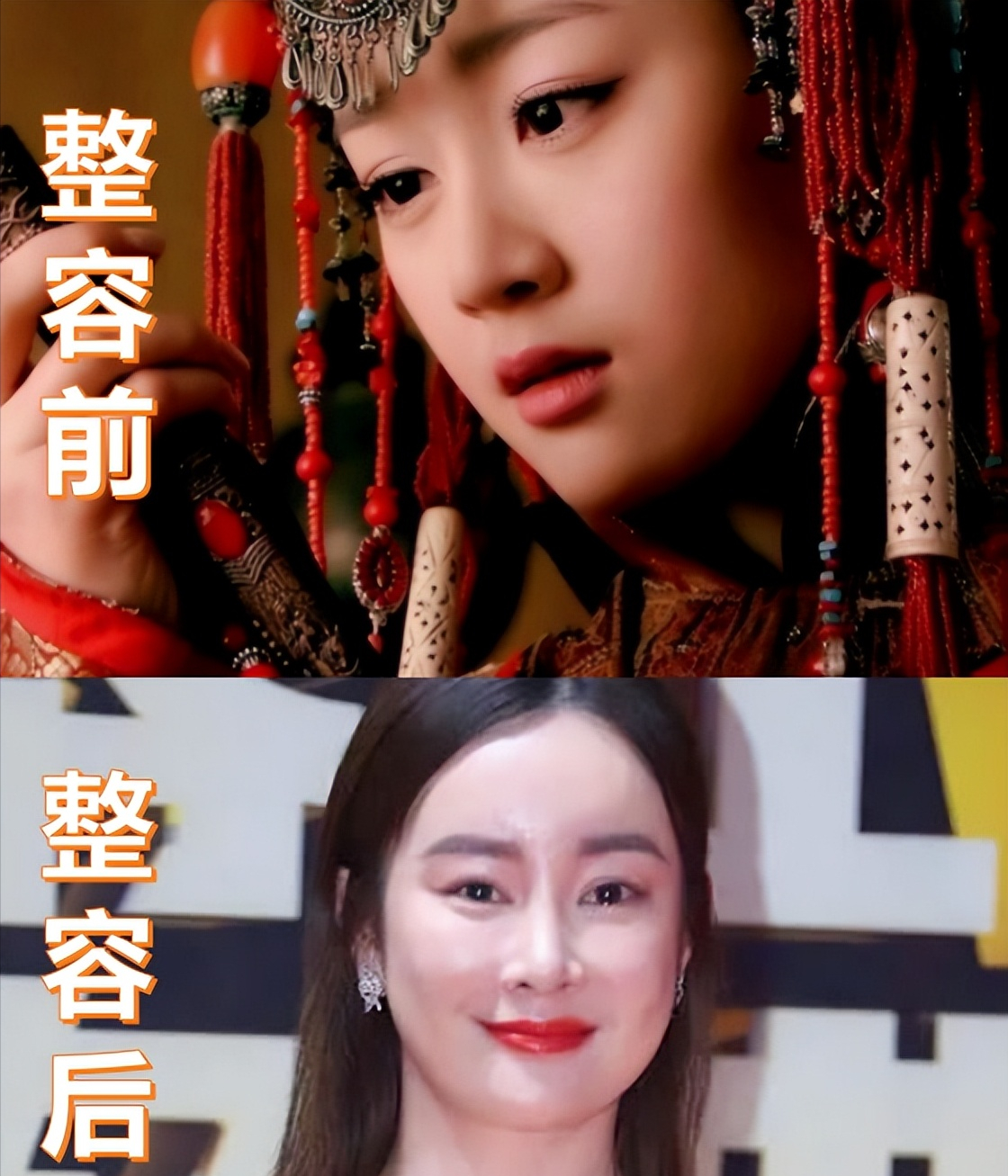 娱乐圈的审美畸形，皮包骨，尖长鼻，为了变瘦使出奇招