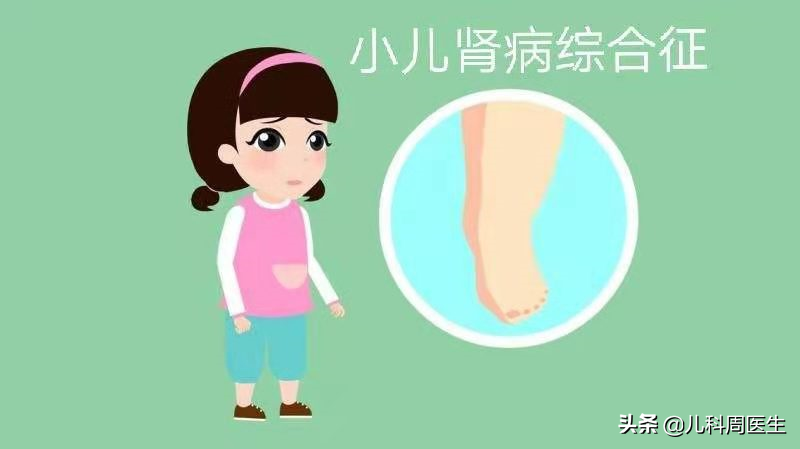 孩子睡醒眼皮肿成“灯泡”？医生说当心肾病，可以治但需注意4点