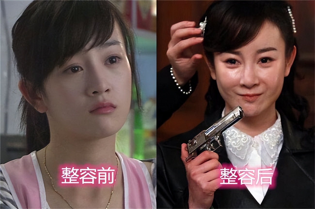 瘦到病态、整容成瘾，痴迷于少女人设，内娱的畸形审美太可怕