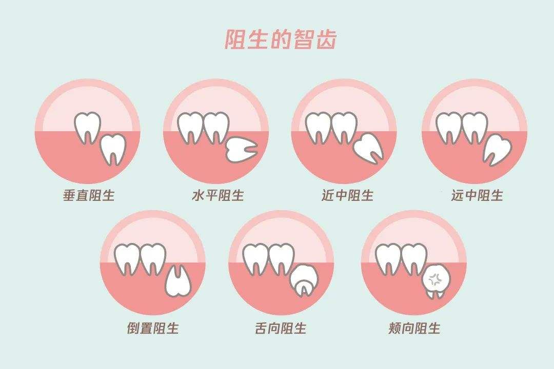 科学家发现人类的Y染色体正在不断缩短，未来的男性将何去何从？