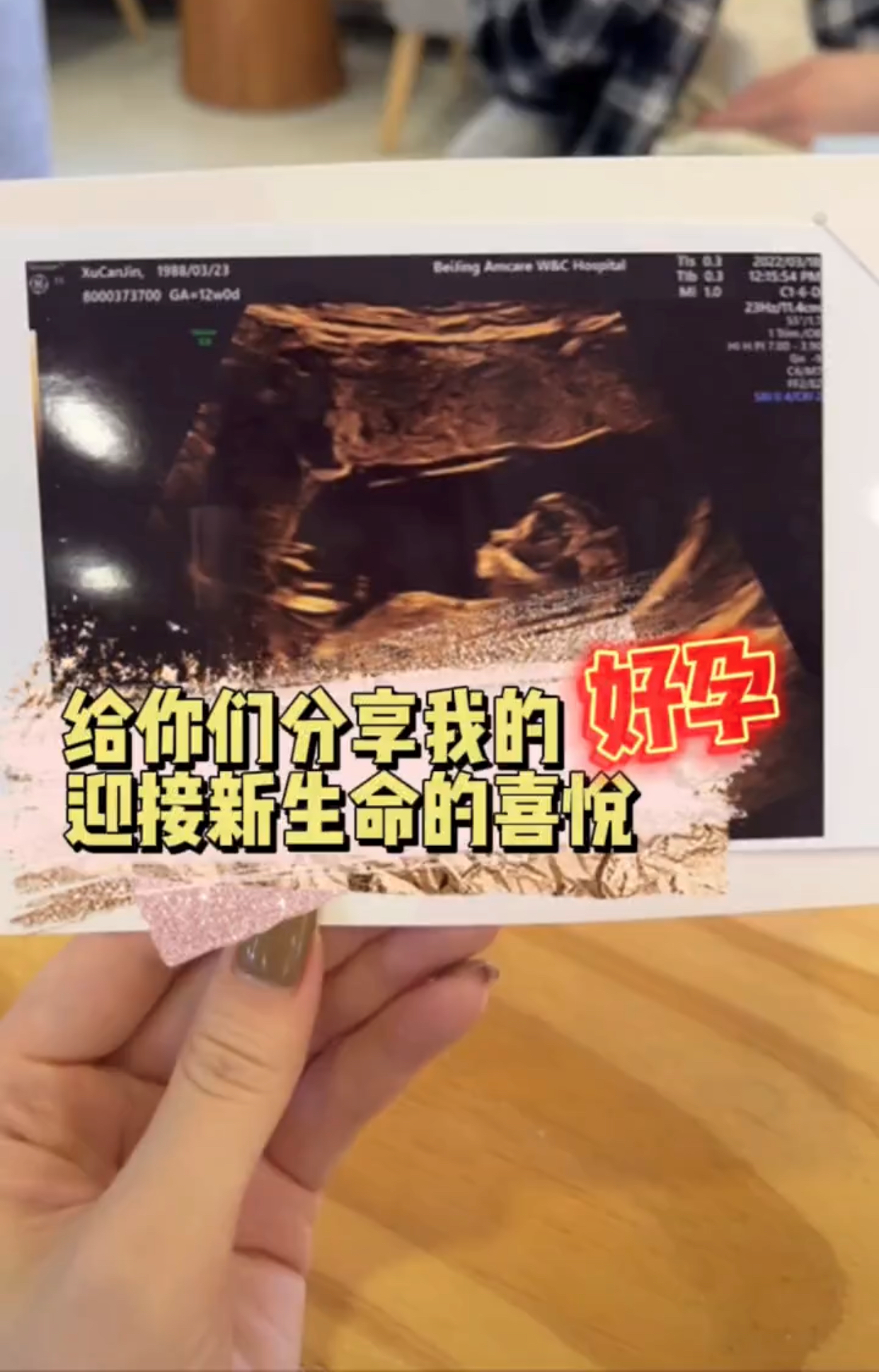 高晓松前妻在商场突遇火灾，孕期挺大肚奔跑撤离，忐忑讲述全过程