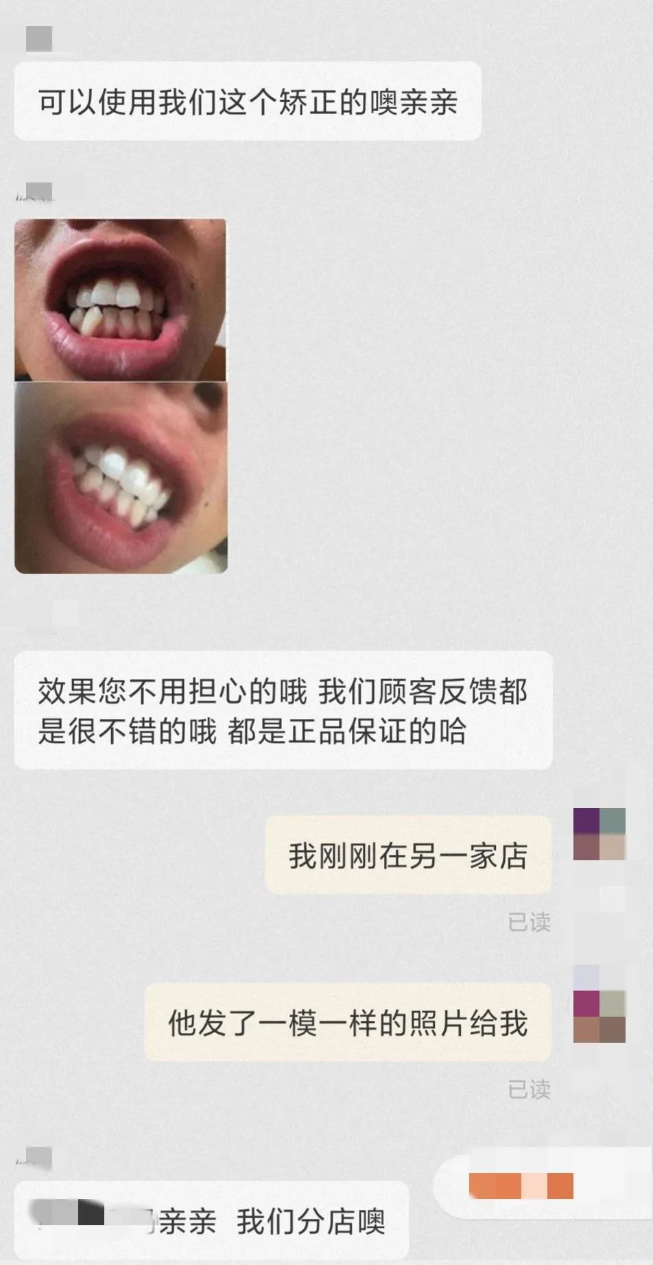 一副牙套不过百，轻松矫正各类牙？痛哭，别在交智商税了