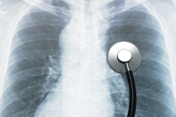 癌症到访，睡觉先知？睡觉时若出现3种症状，建议及时检查