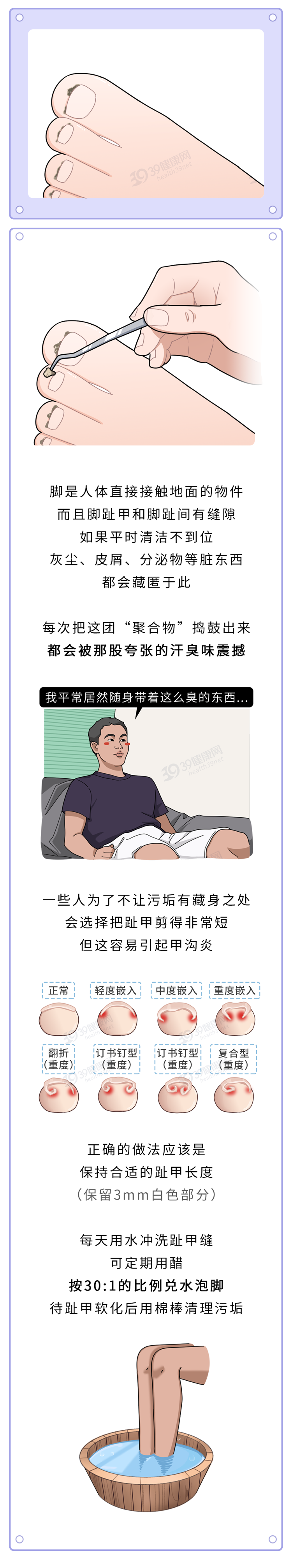 牙缝里软软发臭的黄泥是什么？为什么不能乱抠肚脐眼？终于懂了