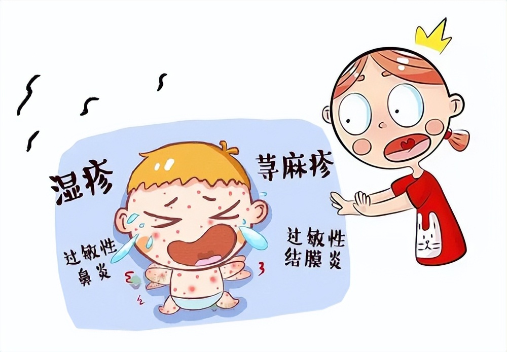 春季宝宝容易出现过敏问题,父母应该如何应对?