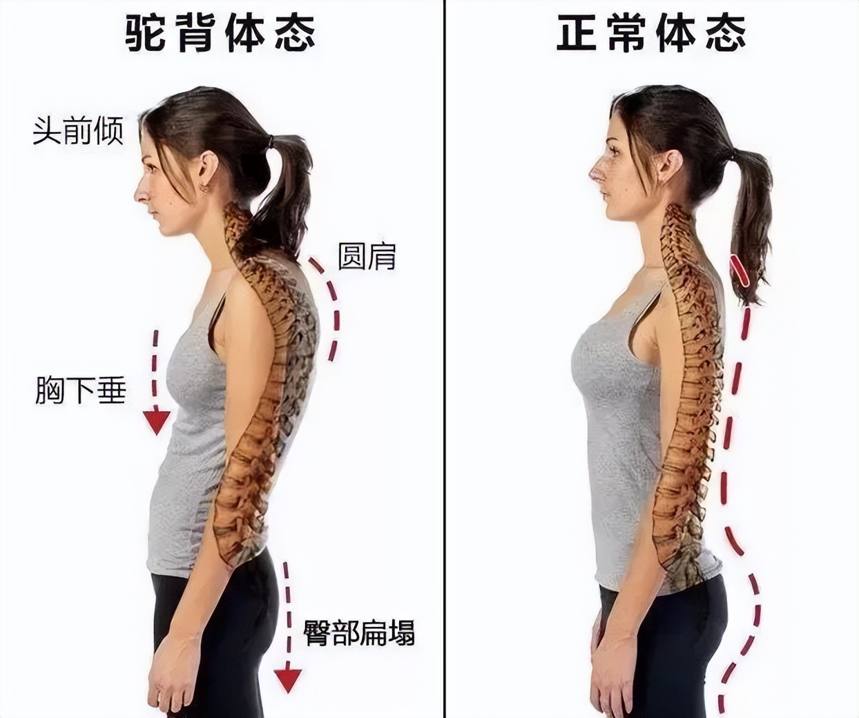 聚攏文胸，女生到底該不該穿聚攏文胸？