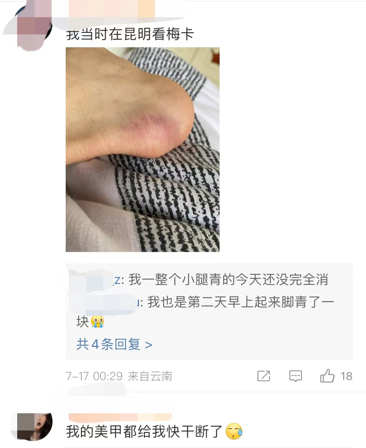 音乐节发生“人砸人”意外！乐迷被跳水者砸晕，伤情严重仍在ICU